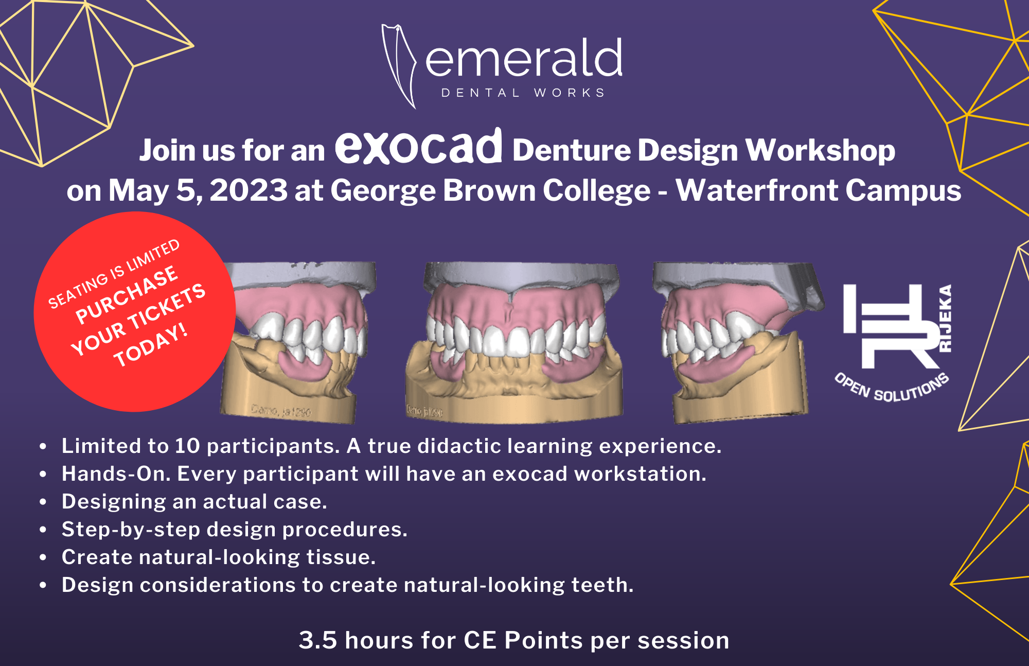 Exocad Denture Design Banner
